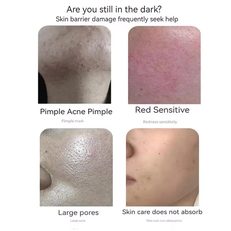 Blue Copper Peptide Freeze-Dried Powder Set Oligopeptide anti Wrinkle Essence Shrink Pores Acne Treatment Skincare Serum 20Pcs